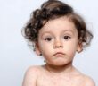 Hautausschlag bei Kindern: Welche Krankheit steckt dahinter? (Foto: AdobeStock - 169526171 luanateutzi)