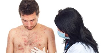 Hautausschlag Allergie: Tipps gegen Quaddeln, Pusteln & rote Flecken