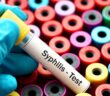 Syphilis-Symptome: Drei Stadien, Behandlung und wie man der Erkrankung vorbeugen kann (Foto: AdobeStock - 135209257 jarun011)