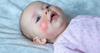 Hautausschlag beim Baby: Welche Erkrankung steckt dahinter? (Foto: AdobeStock - 472628076 AnastazjaSoroka)