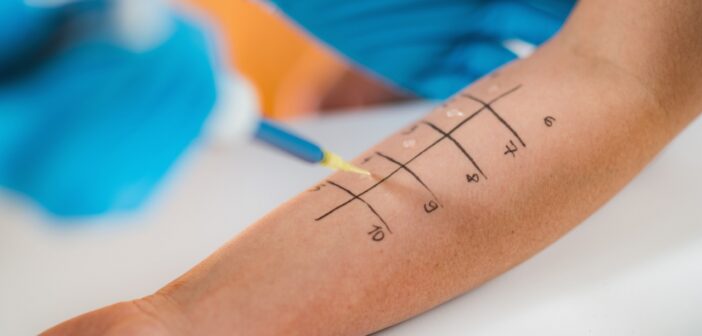 Wenn Bauch, Haut und Energie mitessen: Warum Ernährung bei Allergieprävention genauer betrachtet werden sollte (Foto: AdobeStock - microgen - 278882436)